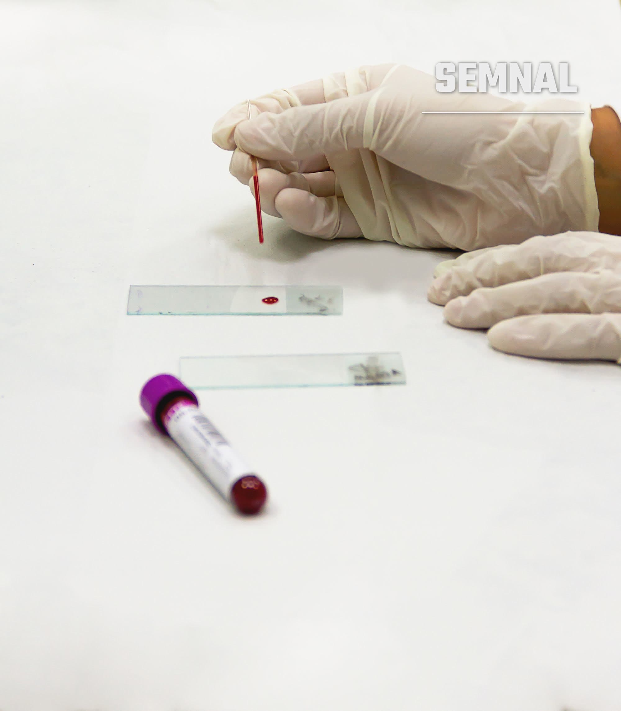 Recoltare de probe de sânge într-un cadru medical, imagine cu caracter ilustrativ