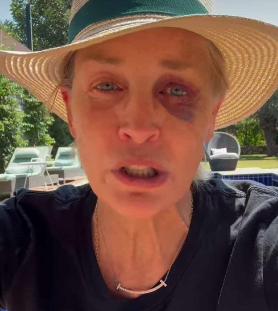 Sharon Stone are un ochi vânăt
