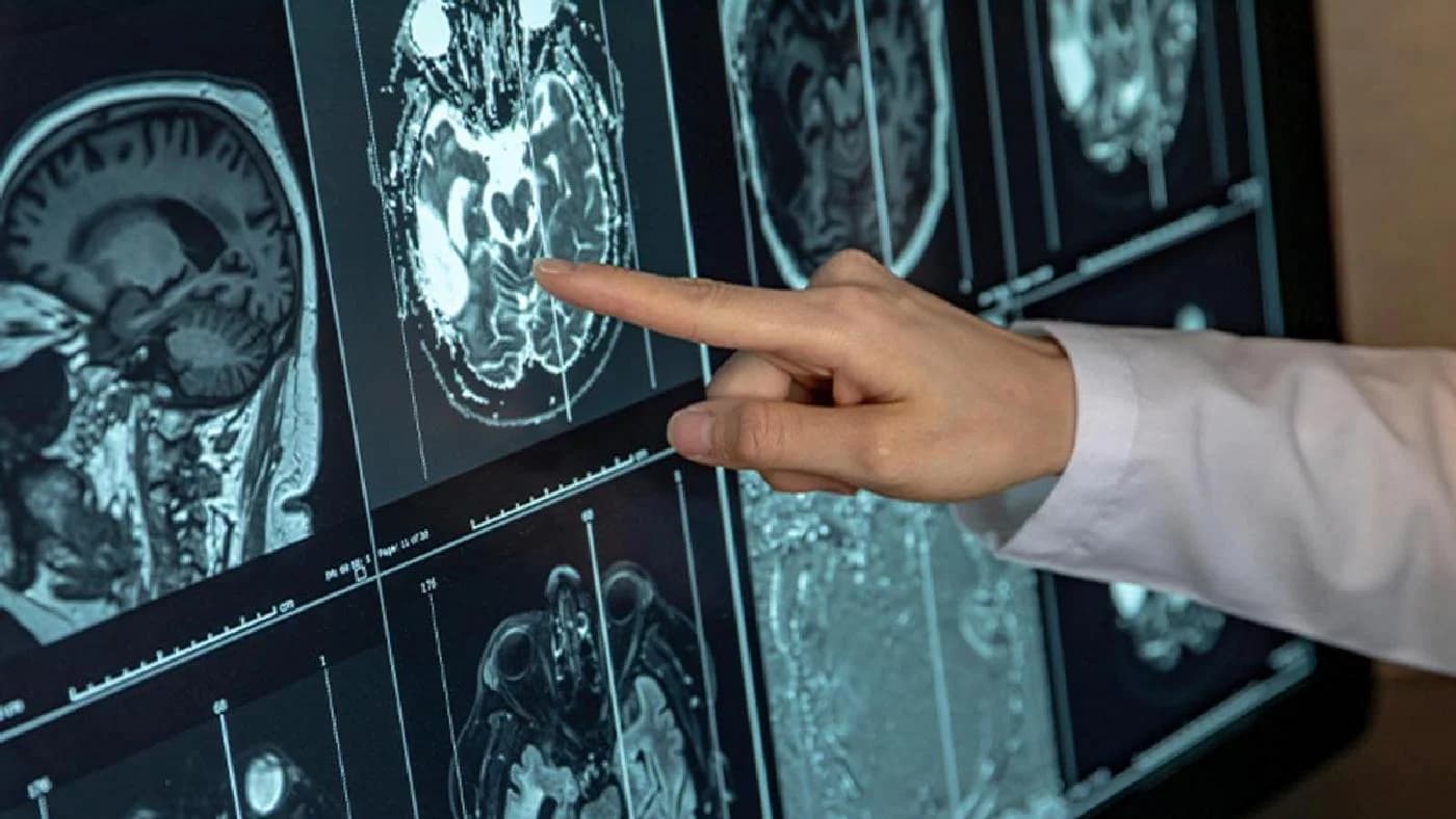 Tehnologie nouă pentru detectarea Alzheimerului timpuriu