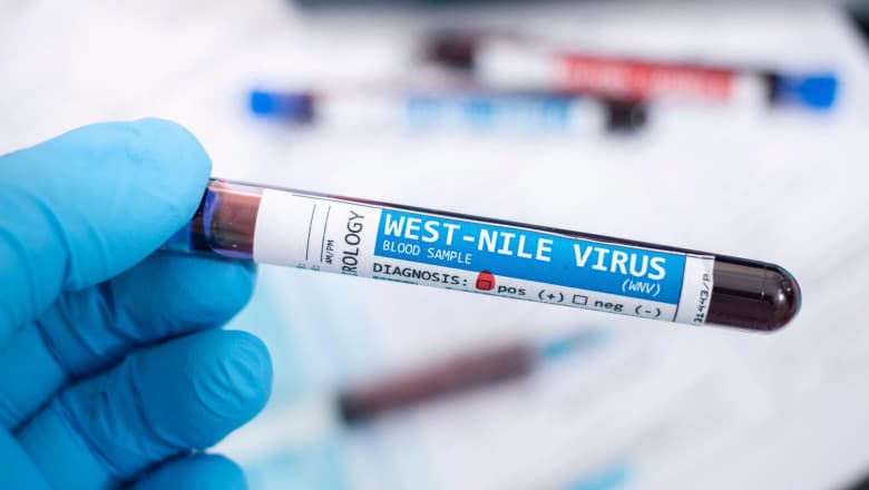 west nile virus