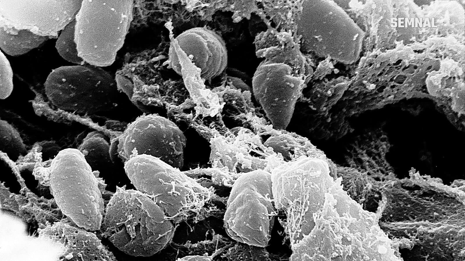 Bacterii Yersinia pestis, agentul ciumei, văzute la microscopul electronic cu baleiaj. Foto: NIAID / Rocky Mountain Laboratories, domeniu public