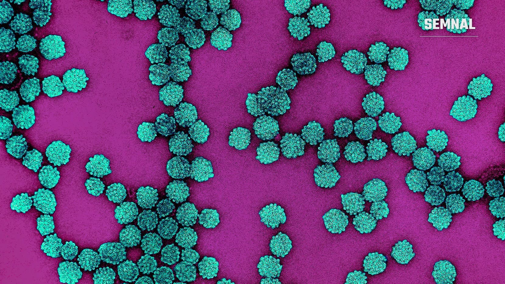 Micrografie electronică colorizată a particulelor de papilomavirus uman (HPV), în nuanțe de turcoaz, pe un fundal violet