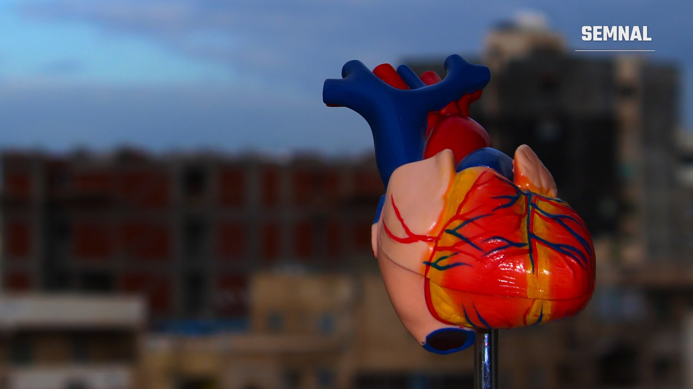 Model anatomic al inimii umane, cu vase de sânge în roșu și albastru, fotografiat pe fundal de cer înnorat și clădiri