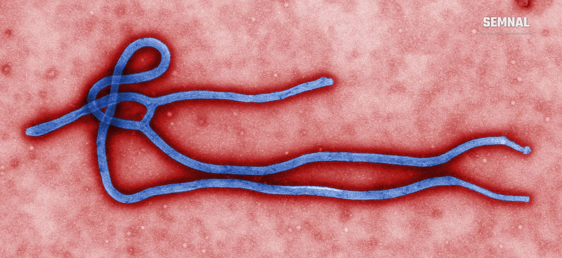 Micrografie electronică colorizată a unui virion Ebola: filament albastru pe fundal roșu