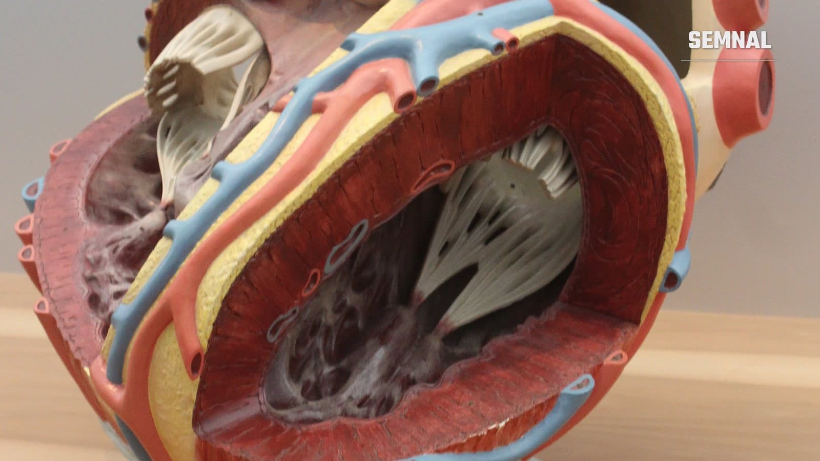 Secțiune printr-un model anatomic al inimii: peretele muscular gros al ventriculului și cordajele tendinoase din interiorul camerei cardiace